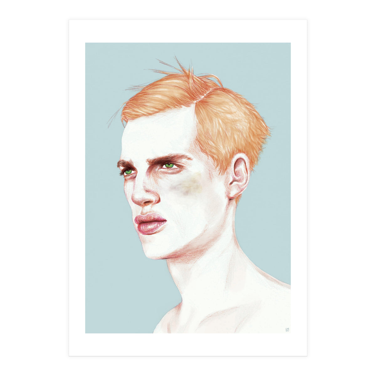 Boy Bruised (Print Only)