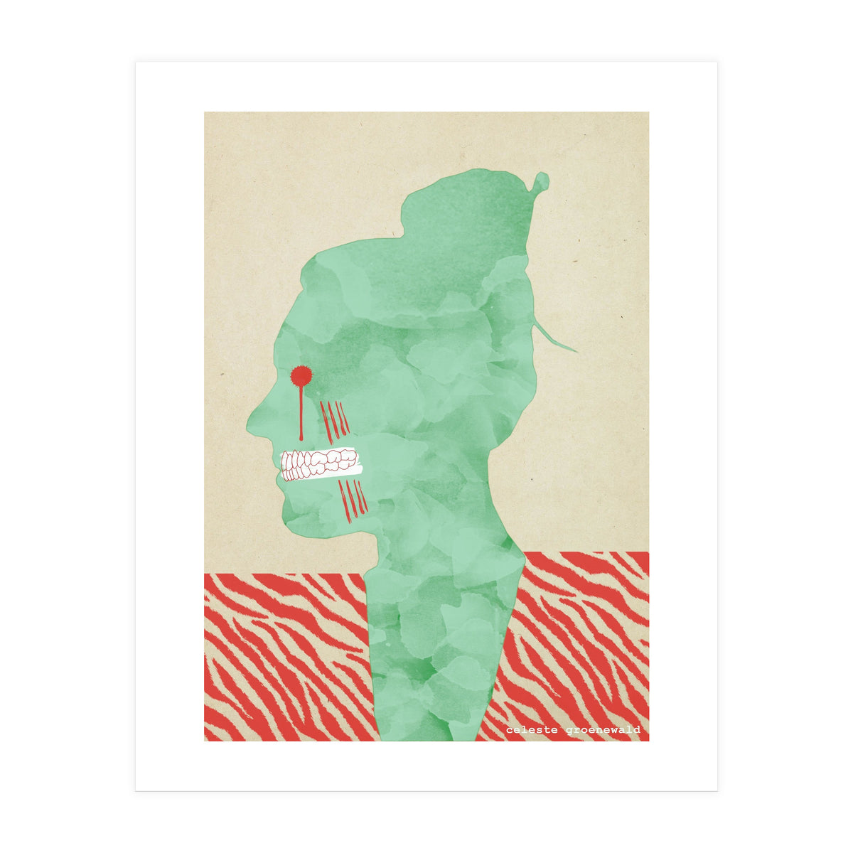 Bruxism (Print Only)