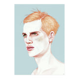 Boy Bruised (Print Only) thumbnail