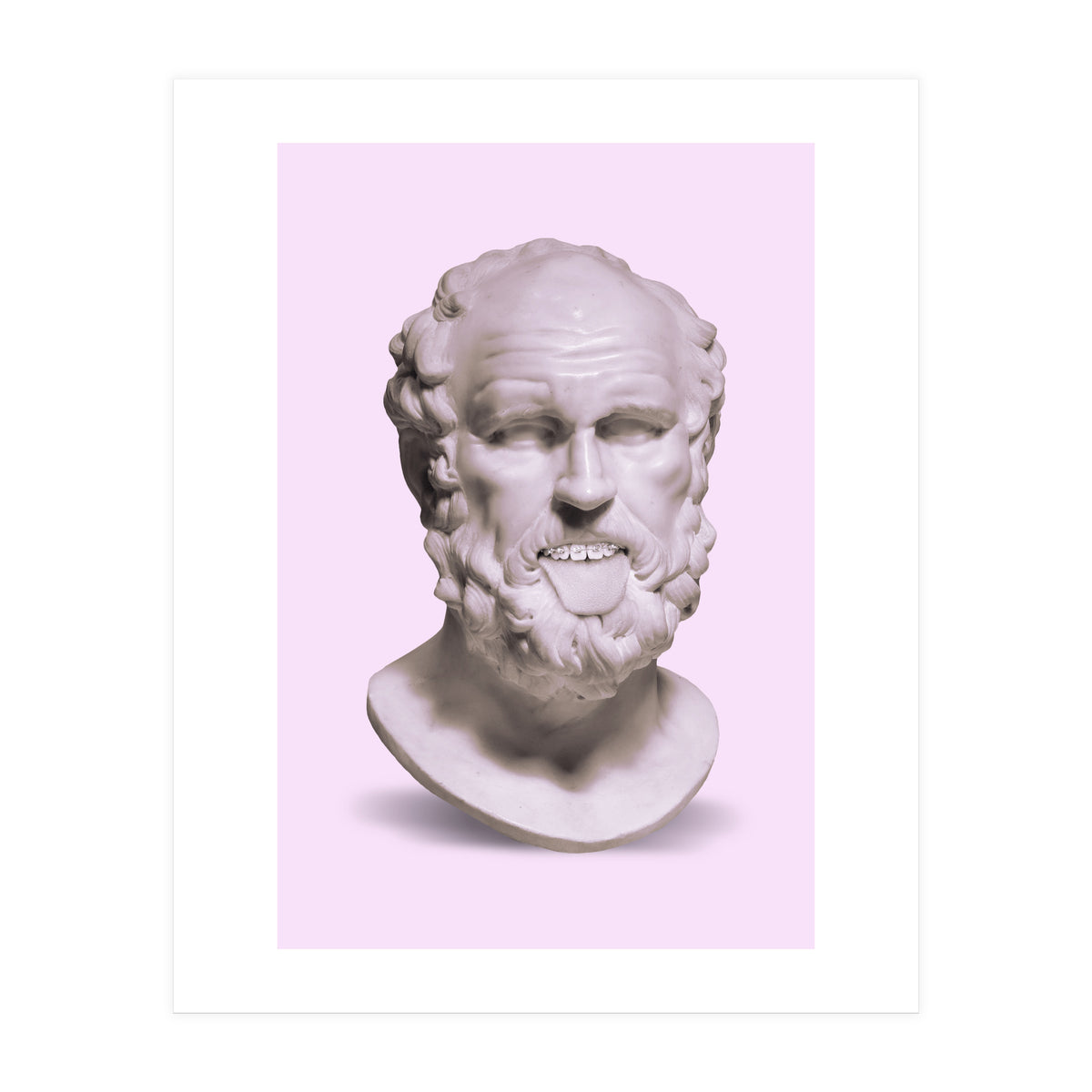 Braces Bust (Print Only)