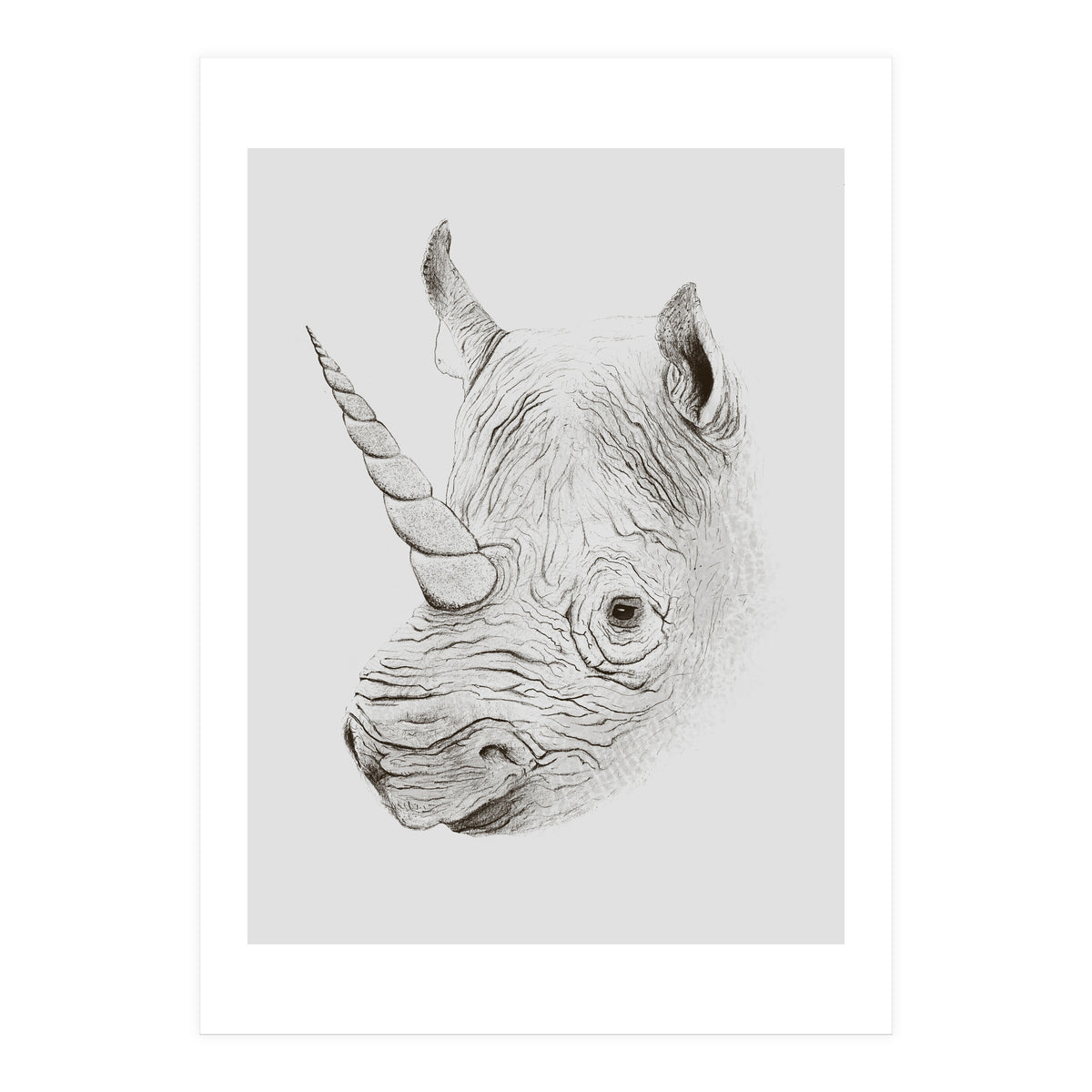 Rhinoplasty (Print Only)