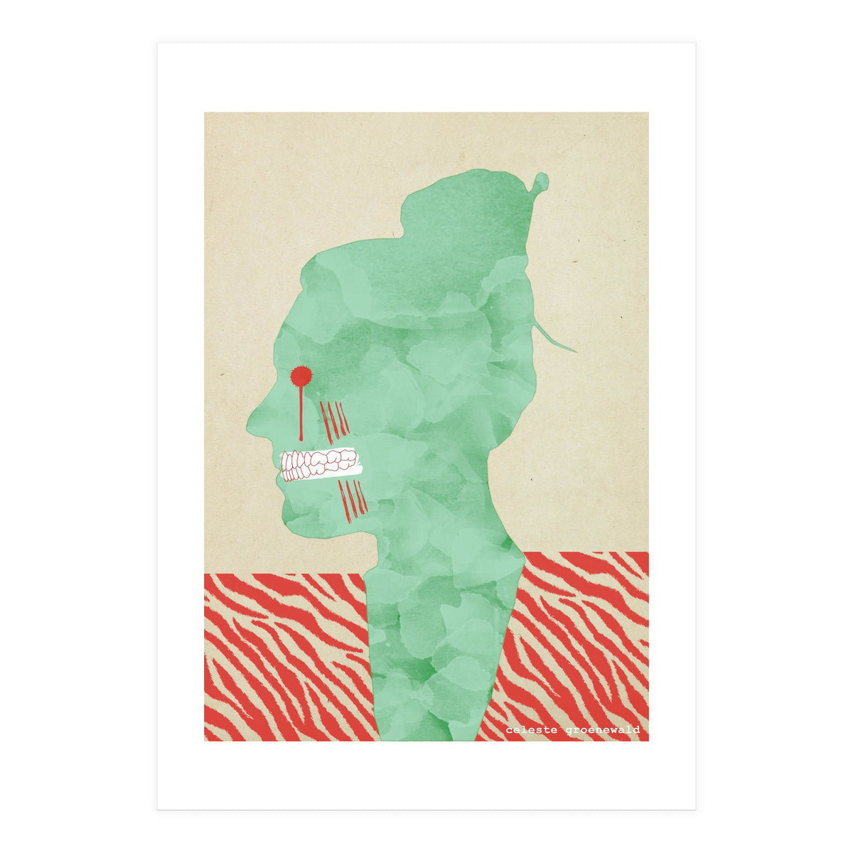 Bruxism (Print Only)