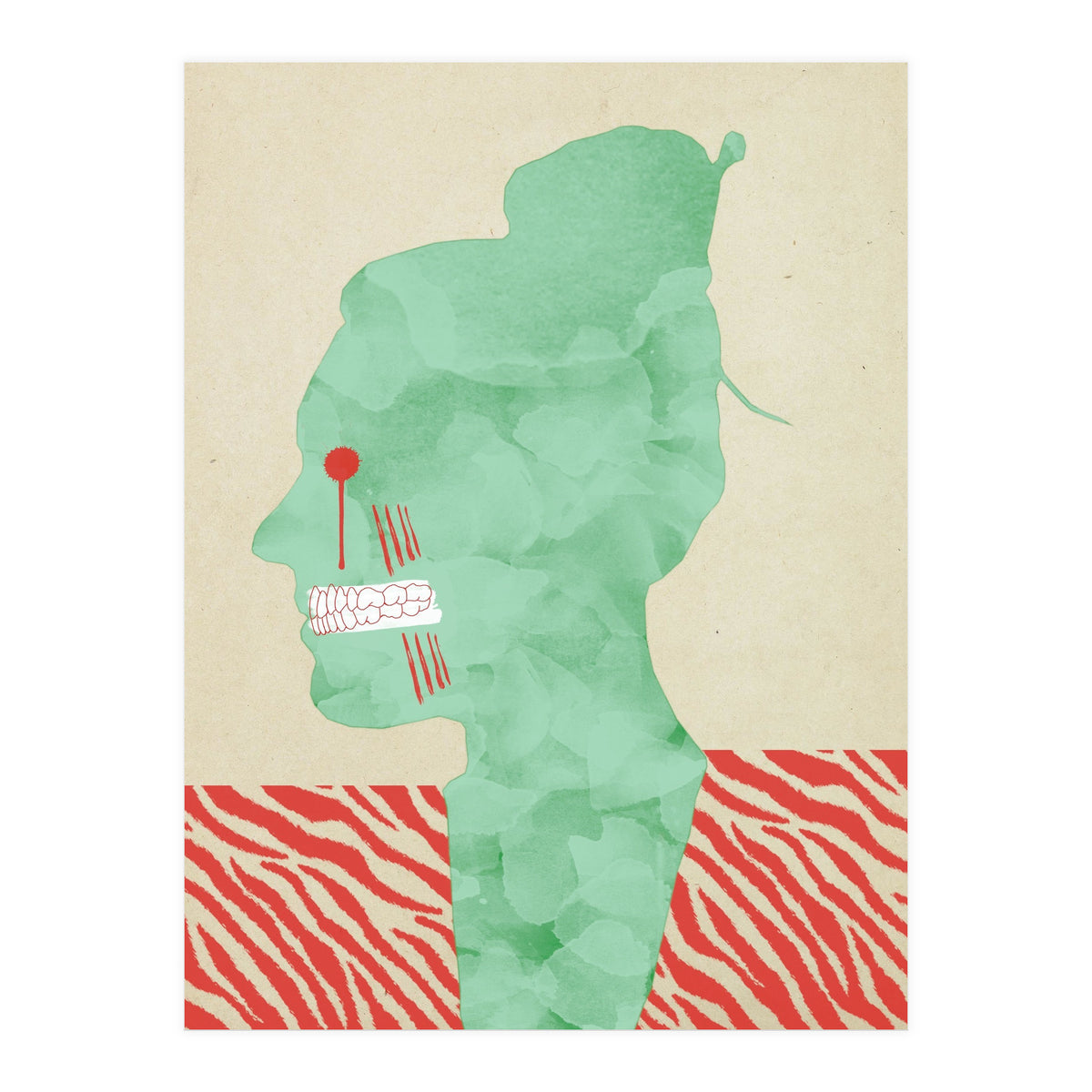 Bruxism (Print Only)