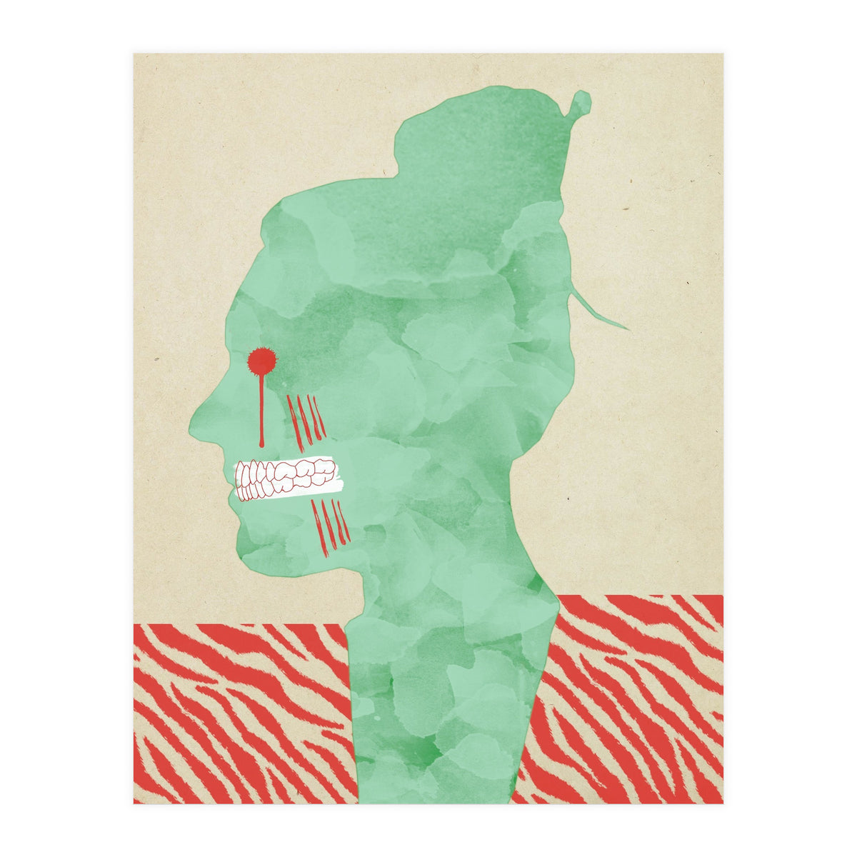 Bruxism (Print Only)