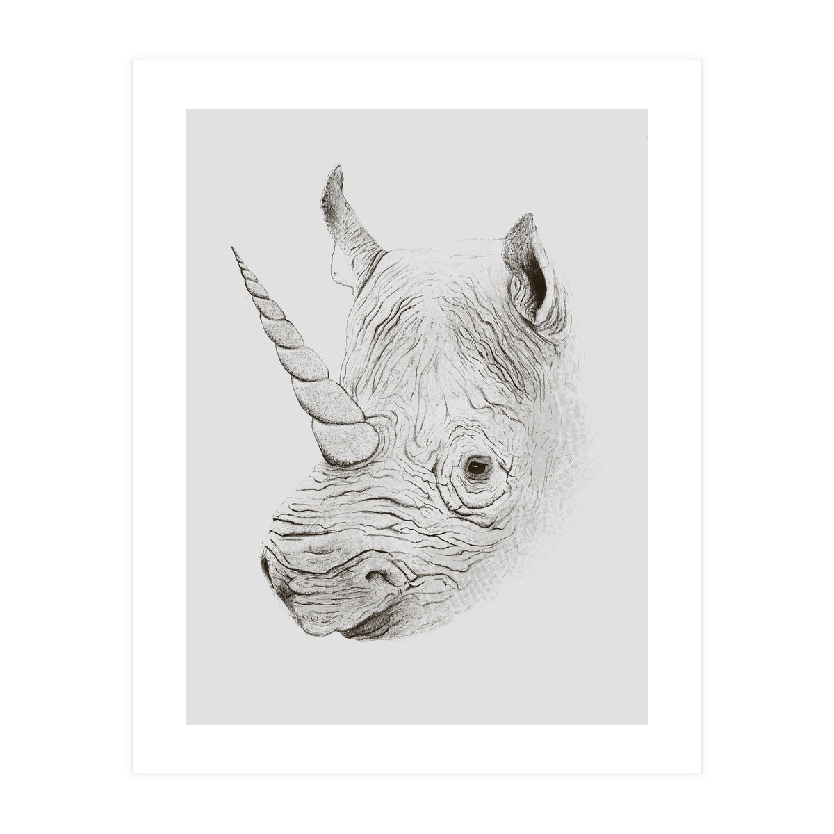 Rhinoplasty (Print Only)