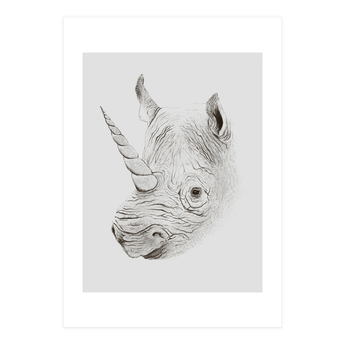 Rhinoplasty (Print Only)