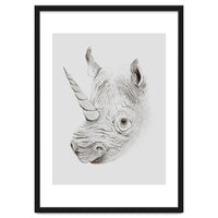 Rhinoplasty