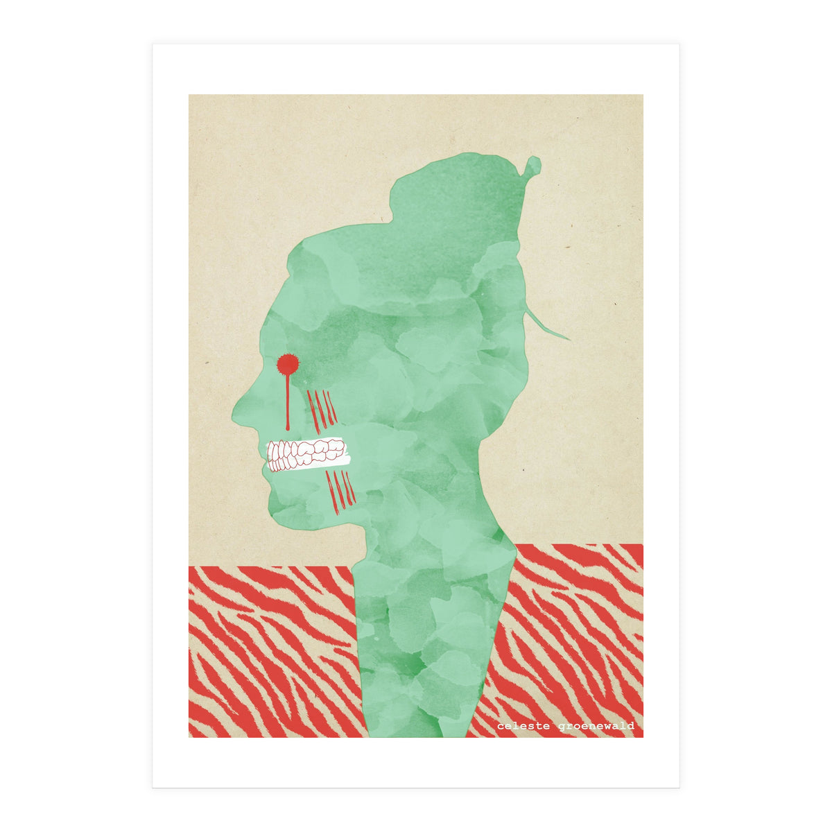 Bruxism (Print Only)