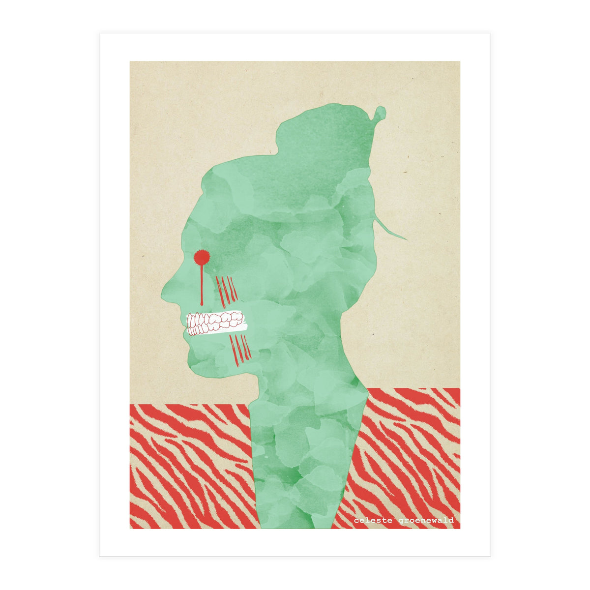 Bruxism (Print Only)