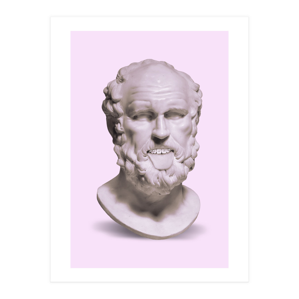 Braces Bust (Print Only)