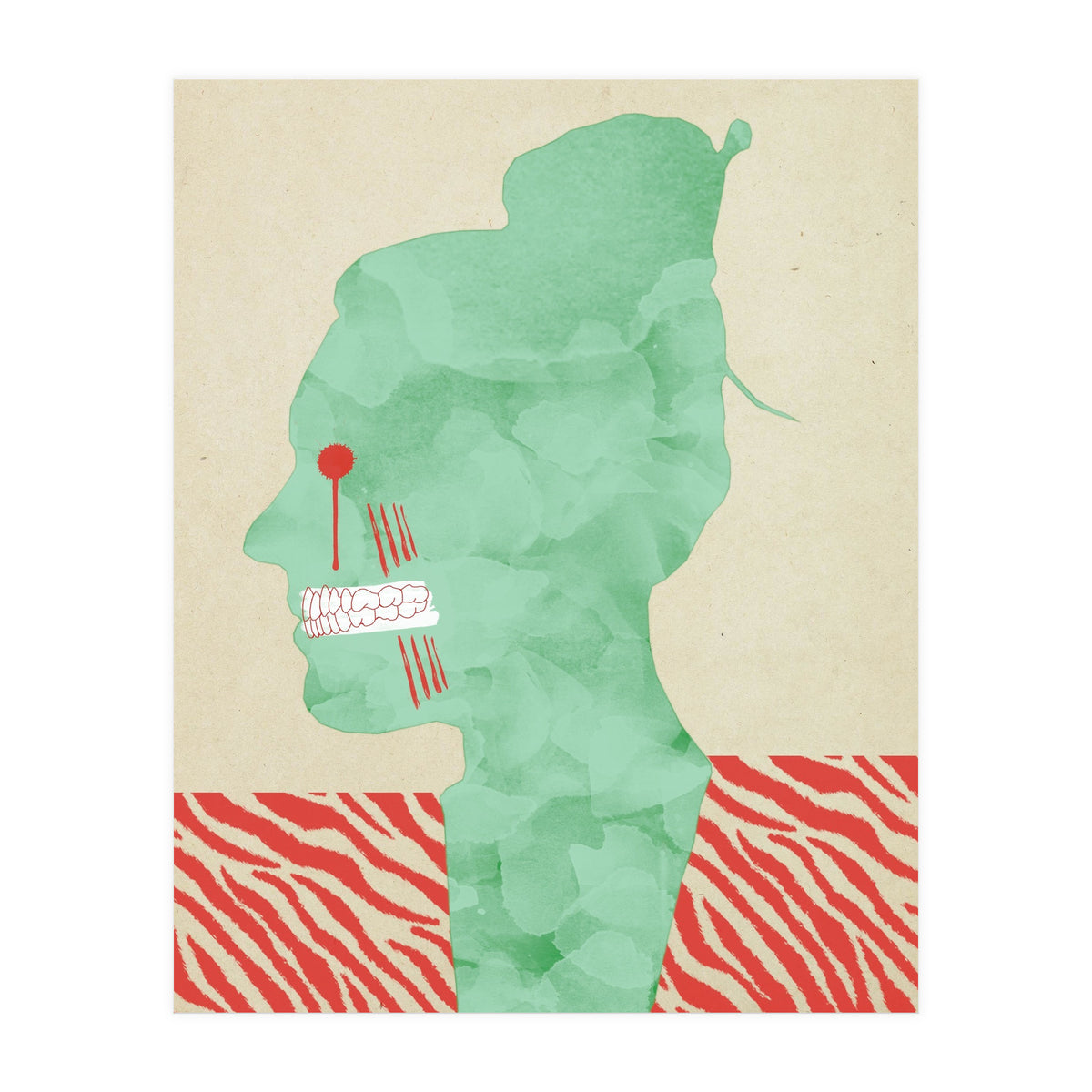 Bruxism (Print Only)