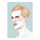 Boy Bruised (Print Only) thumbnail