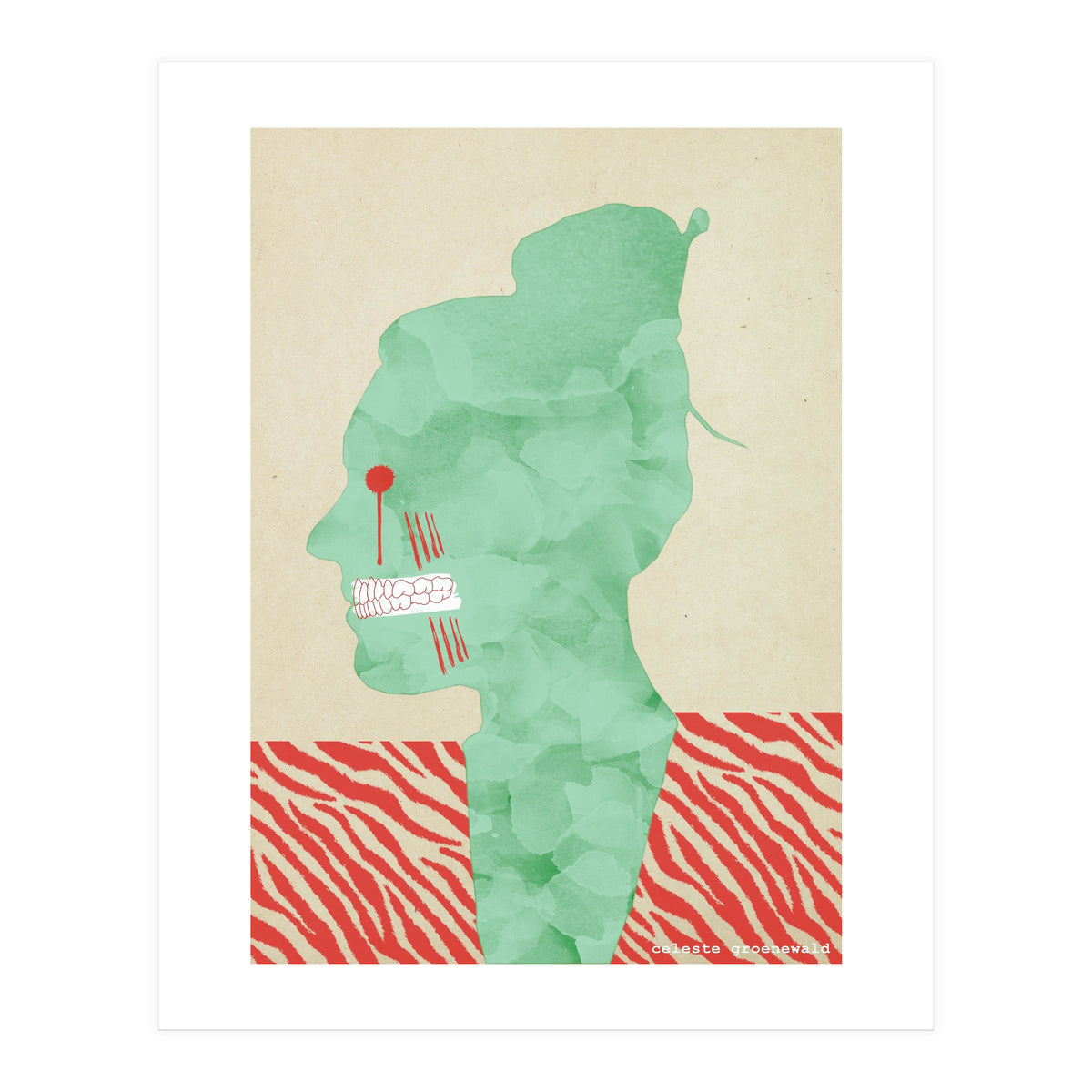 Bruxism (Print Only)