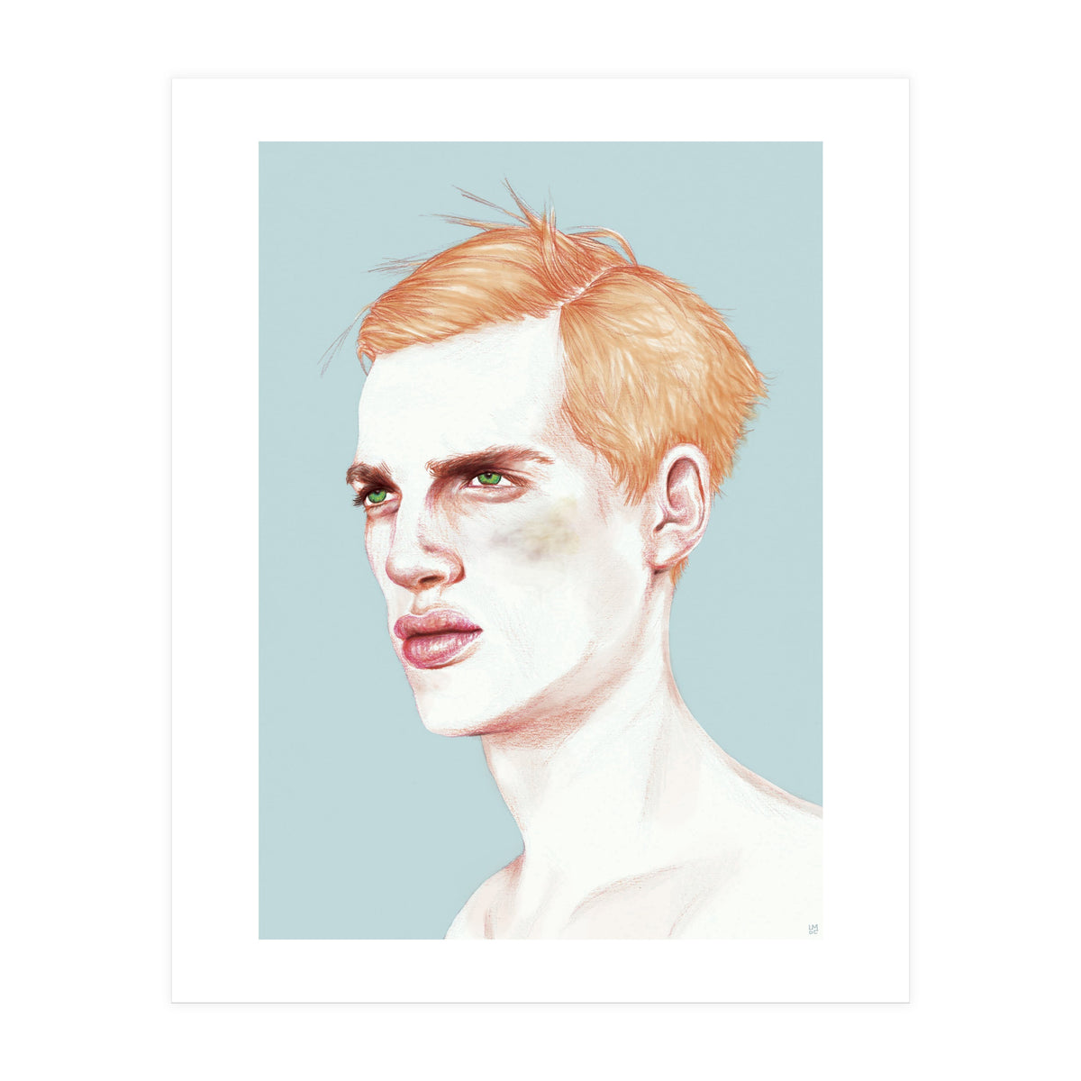 Boy Bruised (Print Only)