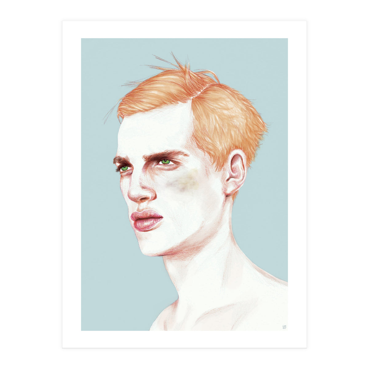 Boy Bruised (Print Only)