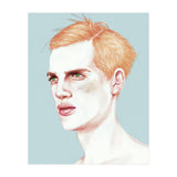 Boy Bruised (Print Only) thumbnail