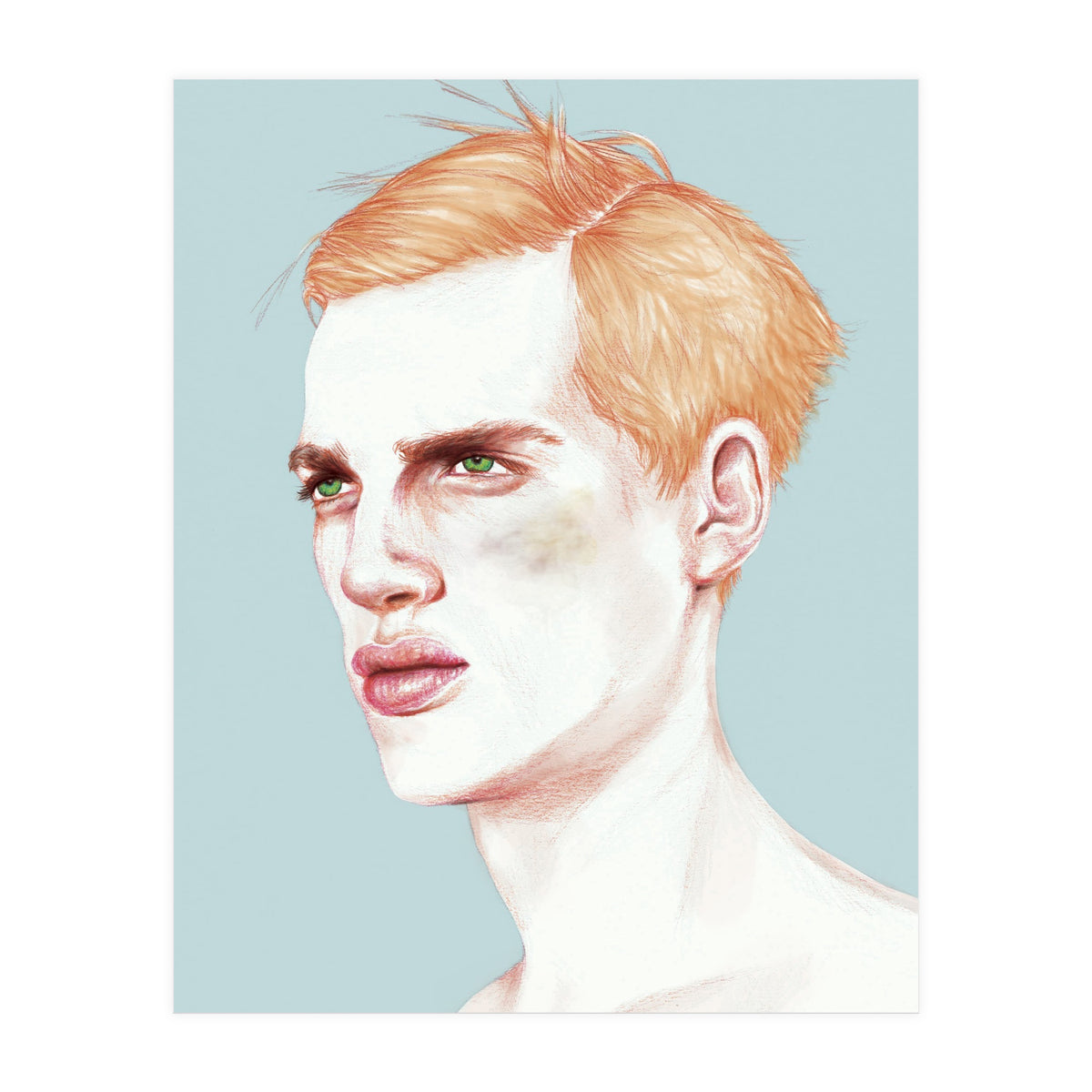Boy Bruised (Print Only)